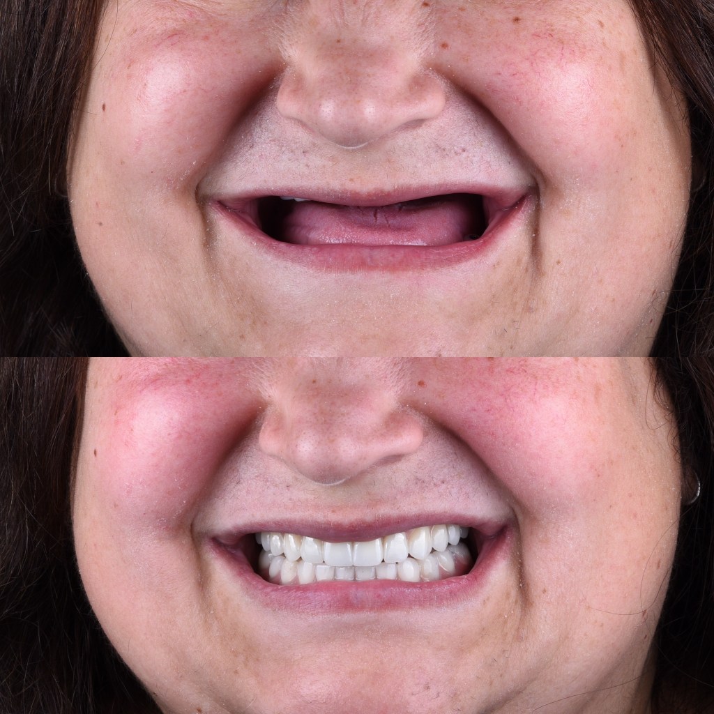 Cand este momentul sa alegi  fast &&nbsp;fixed